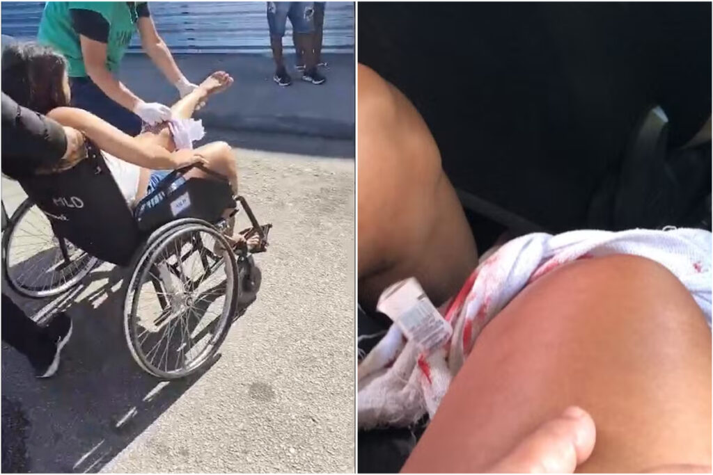 gravida-e-baleada-durante-tiroteio-e-passa-por-parto-de-urgencia-no-rj