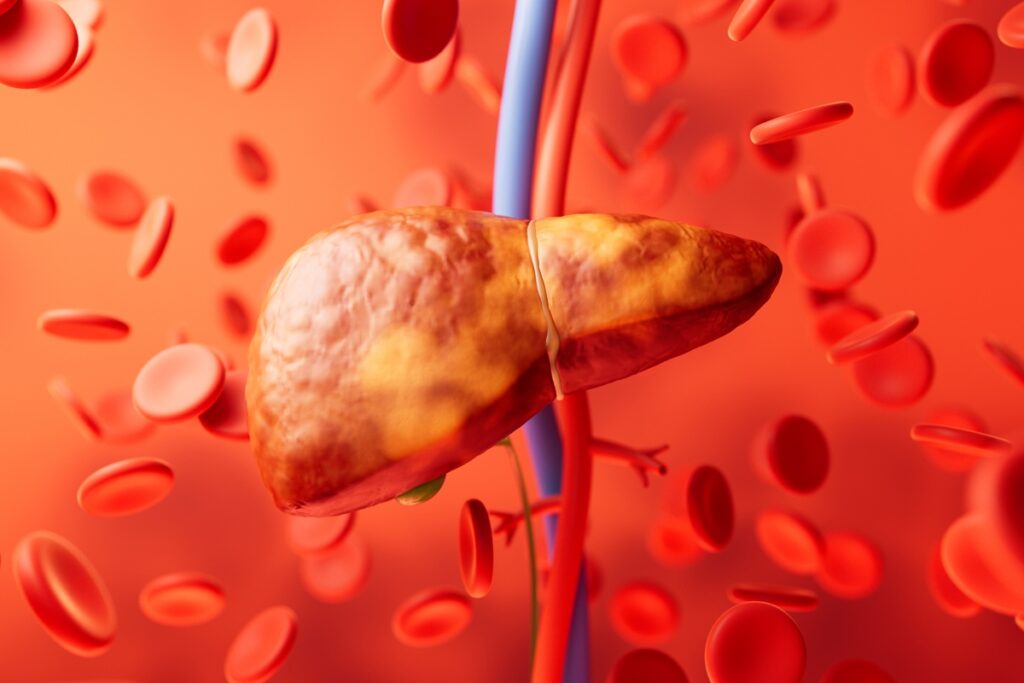 gordura-no-figado:-saiba-por-que-e-vital-proteger-o-orgao-da-condicao