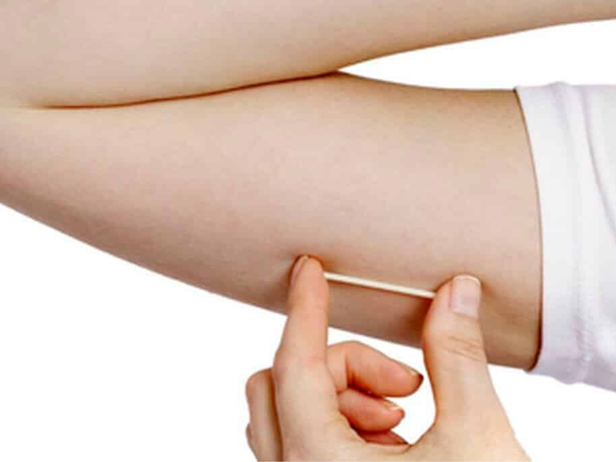 Anvisa suspende medicamentos manipulados e implantes hormonais da Elmeco