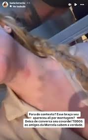 namorada-de-dado-dolabella-desiste-de-processa-lo-apos-denuncia-de-agressao,-afirma-advogado