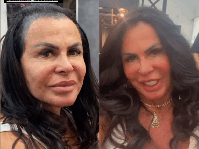 “nao-tenho-mais-cabelo”:-gretchen-desabafa-sobre-queda-capilar