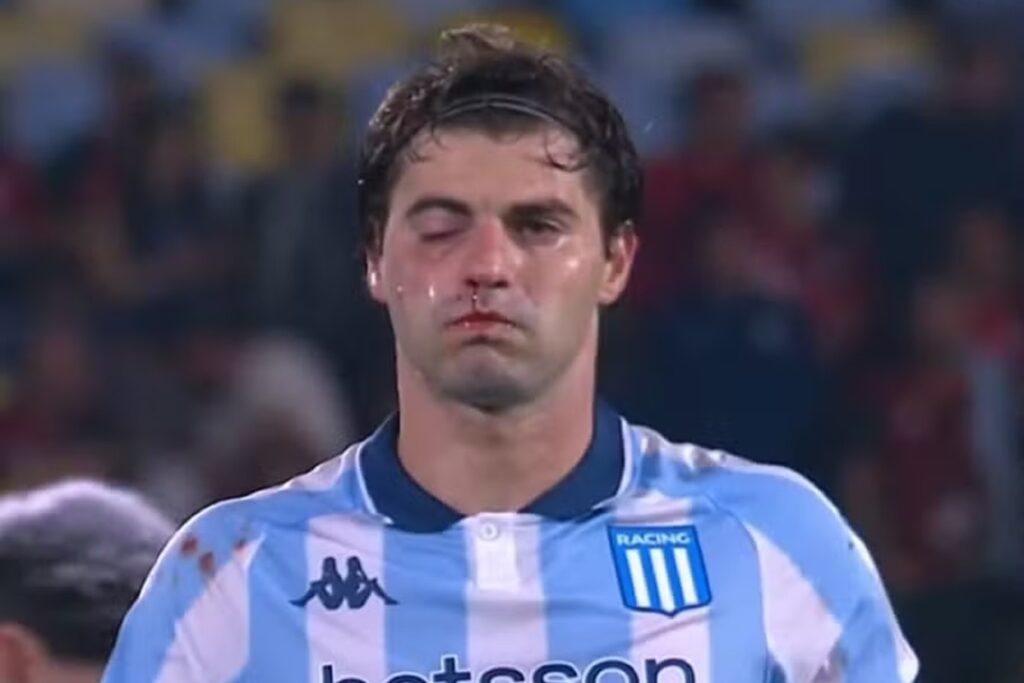 titular-do-racing-passa-por-cirurgia-e-perde-jogo-contra-o-flamengo