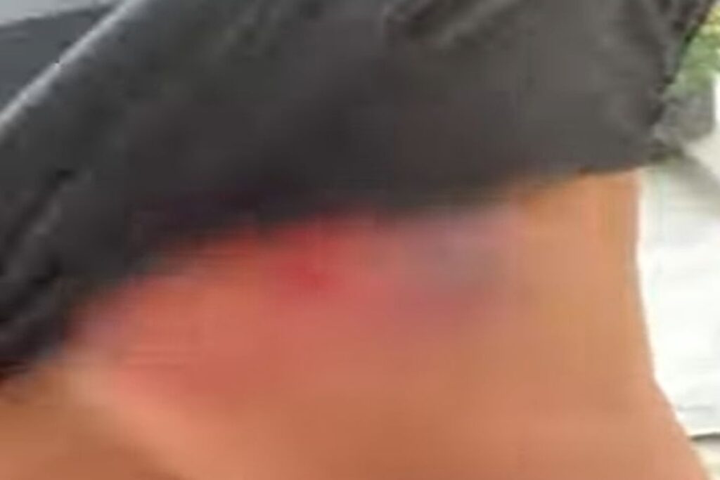 “abencoado”:-policial-mostra-colete-furado-apos-ser-atingido-por-tiro-no-rj