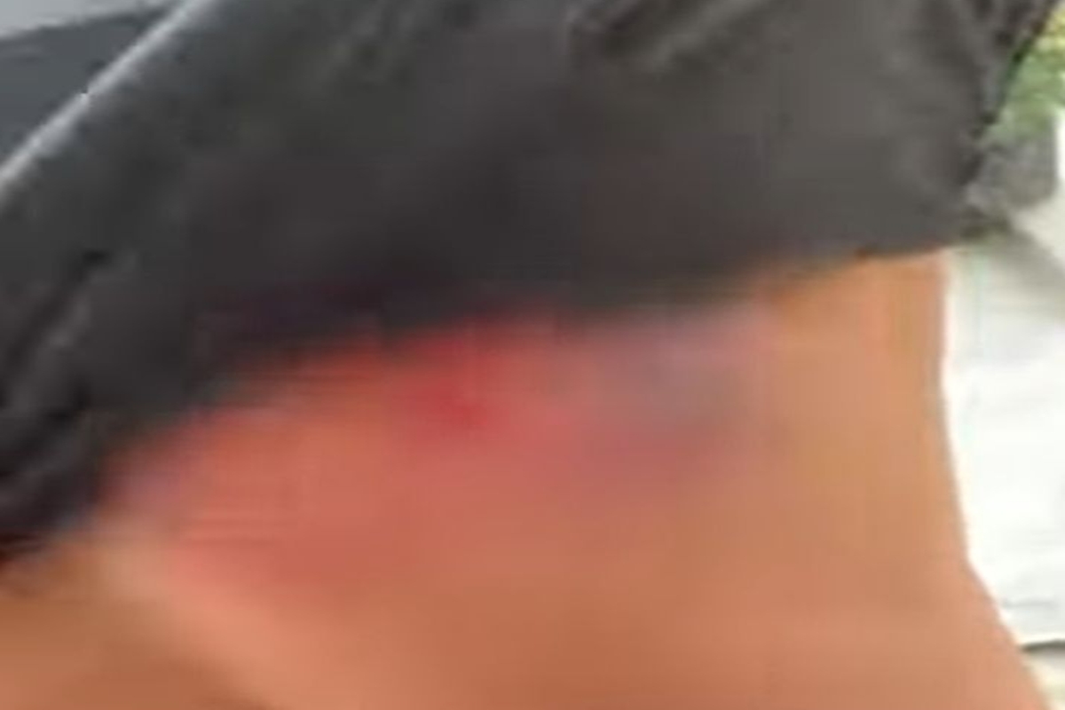 “Abençoado”: policial mostra colete furado após ser atingido por tiro no RJ
