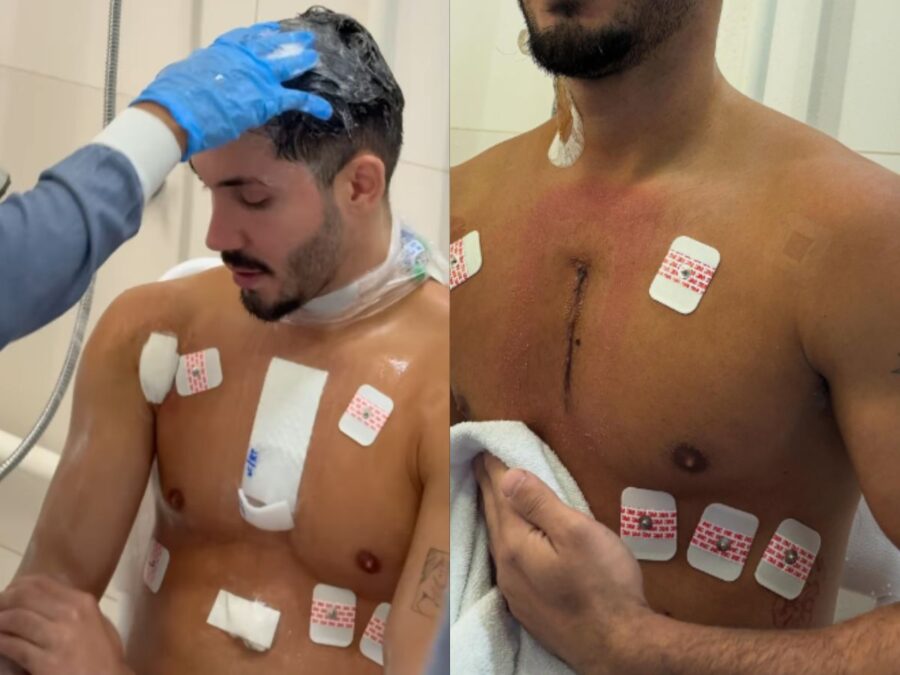 Influenciador Vittor Fernando mostra sequelas após carro ser alvejado no RJ: “Vi a morte”