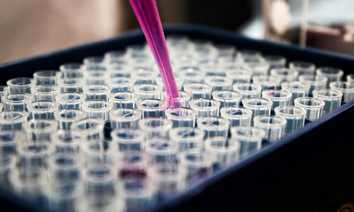 Pesquisas brasileiras avançam no diagnóstico do Alzheimer com exame de sangue