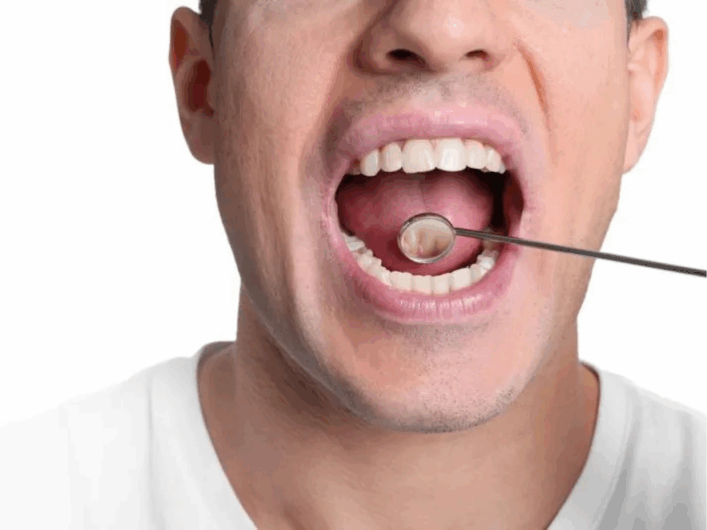 fatores-de-risco-e-prevencao-do-cancer-bucal:-tudo-que-voce-precisa-saber