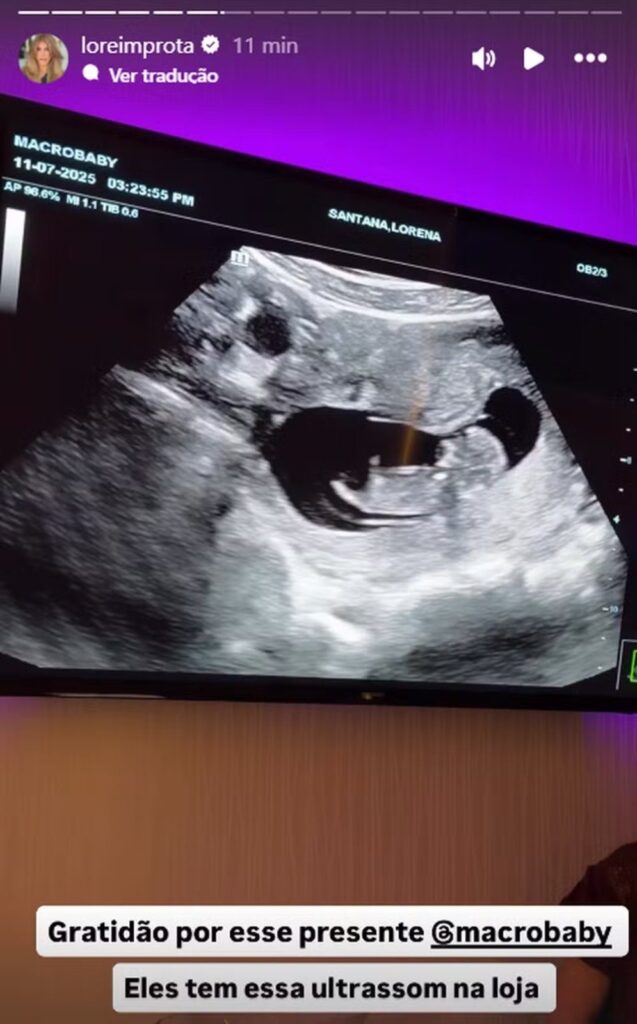 lore-improta-vibra-ao-compartilhar-ultrassom-da-2a-gestacao:-“ta-dancando”