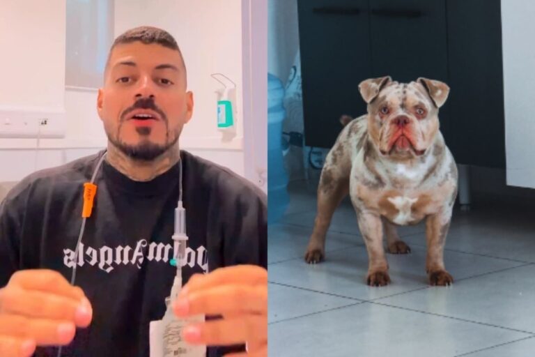 influenciador-acorda-sem-dedo-e-descobre-que-cachorro-comeu-o-membro