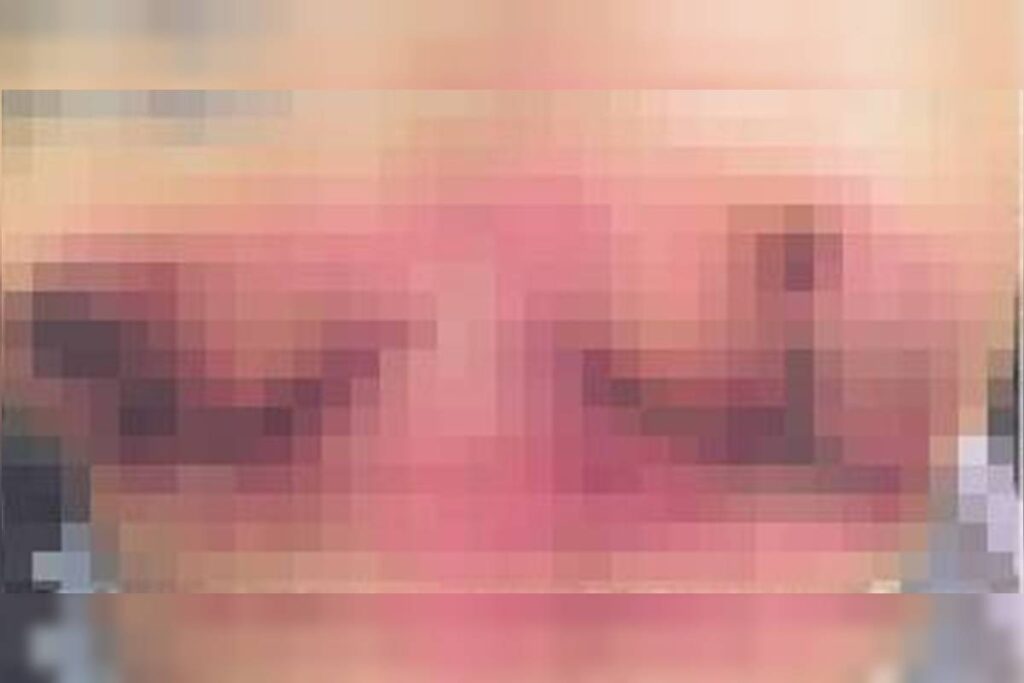 mulher-denuncia-medico-do-df-por-erro-apos-perder-os-seios-em-cirurgia