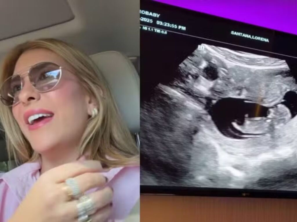 “era-um-sonho”:-lore-improta-celebra-2a-gravidez-e-da-palpite-sobre-sexo-do-bebe