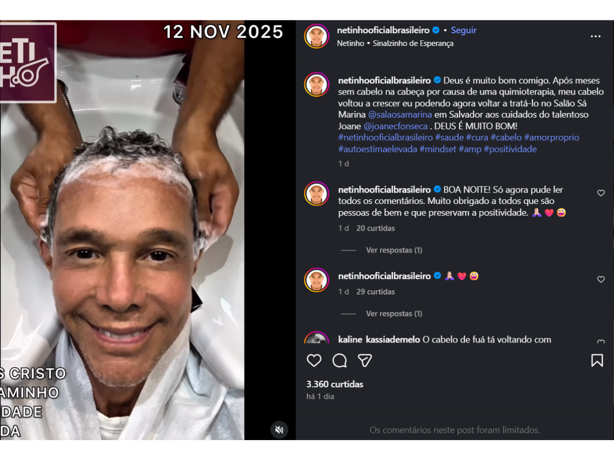 Netinho comemora crescimento do cabelo após cura do câncer: “Deus é muito bom”
