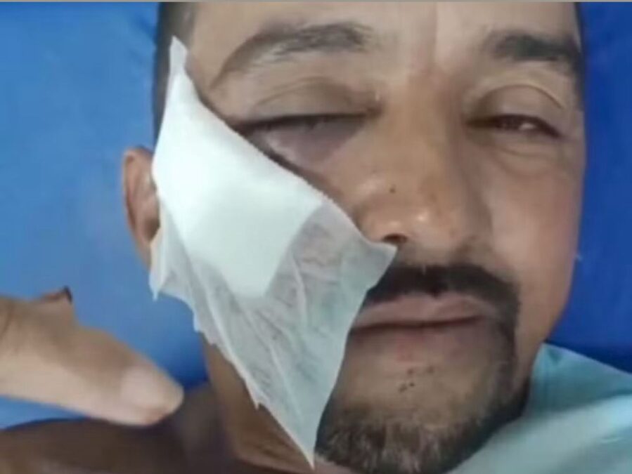Tijolada no rosto: gari é agredido por morador após briga sobre lixo