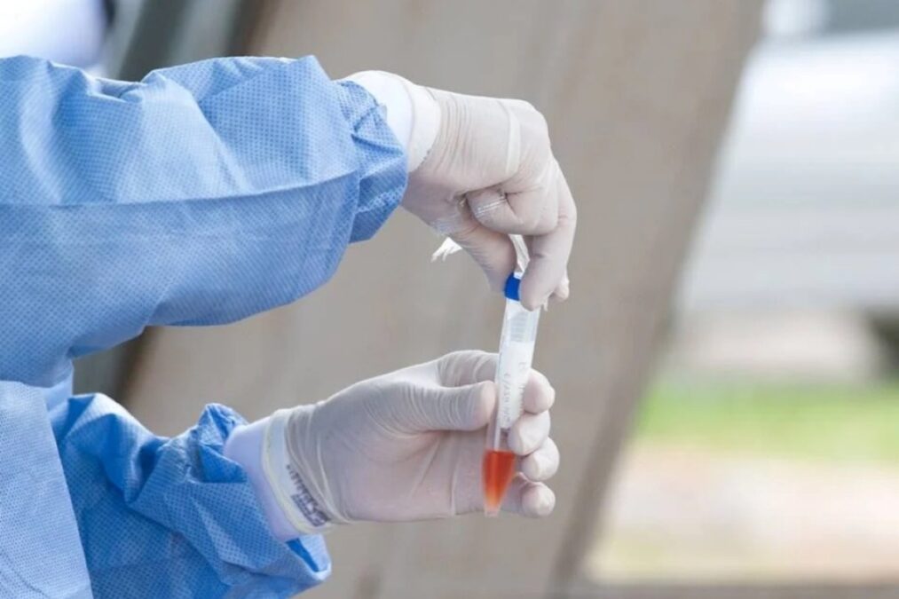 Saúde põe em sigilo valor da compra de 73 milhões de testes de Covid