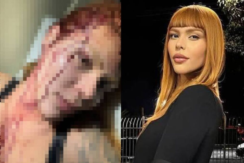 Modelo é atacada por 4 na zona leste de SP: “Transfobia é cruel”