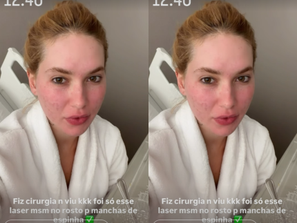 apos-procedimento-a-laser,-virginia-reaparece-e-explica-tratamento-no-rosto