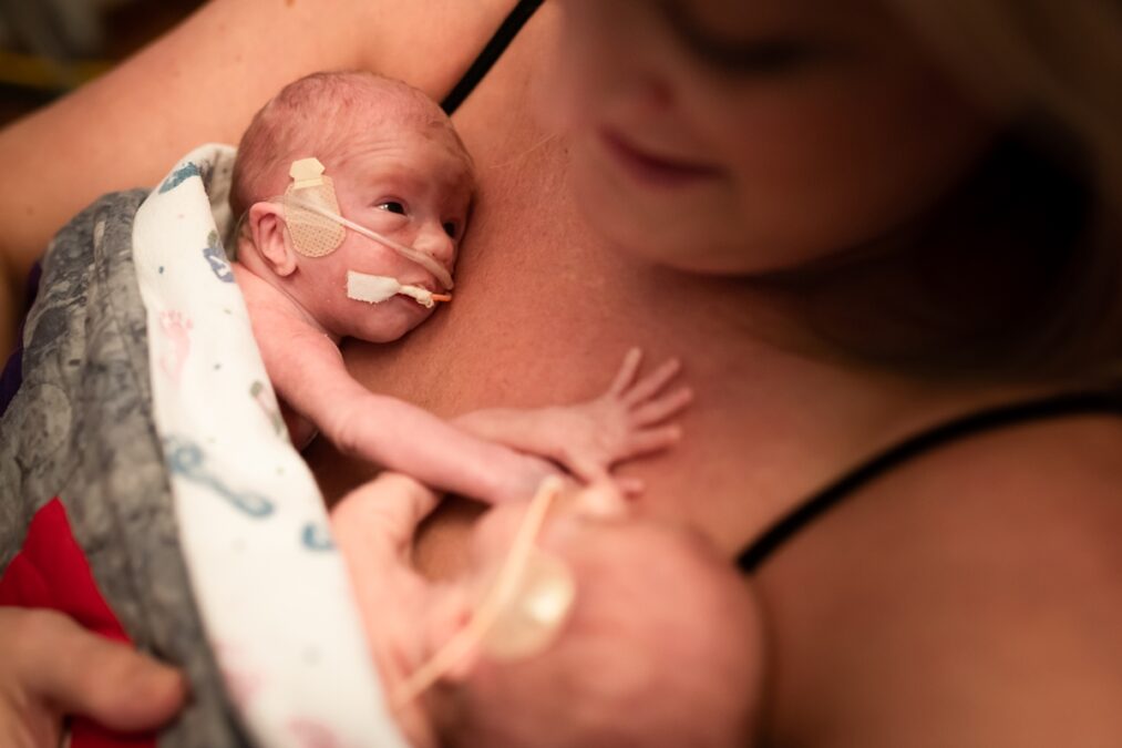 Prematuridade: veja riscos e cuidados essenciais para proteger o bebê