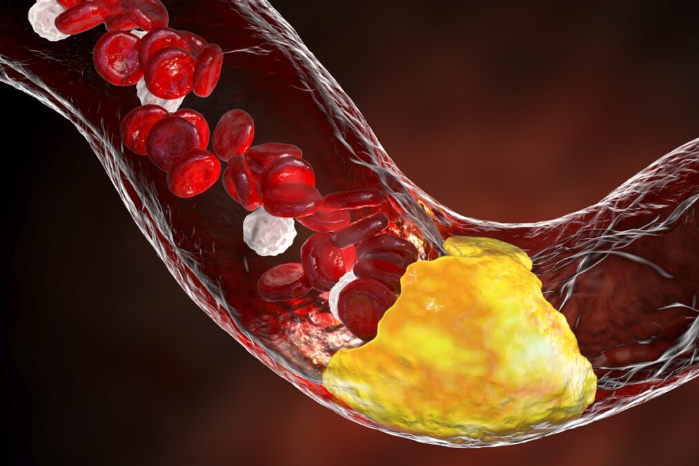 Médico vascular elege as melhores frutas para a saúde das artérias