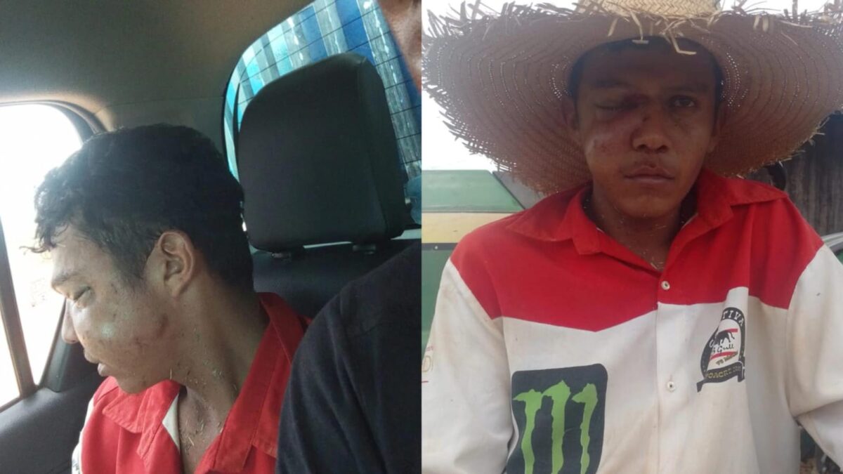 Boi ataca trabalhador rural durante serviço em fazenda no Ramal Nova Olinda, em Sena Madureira