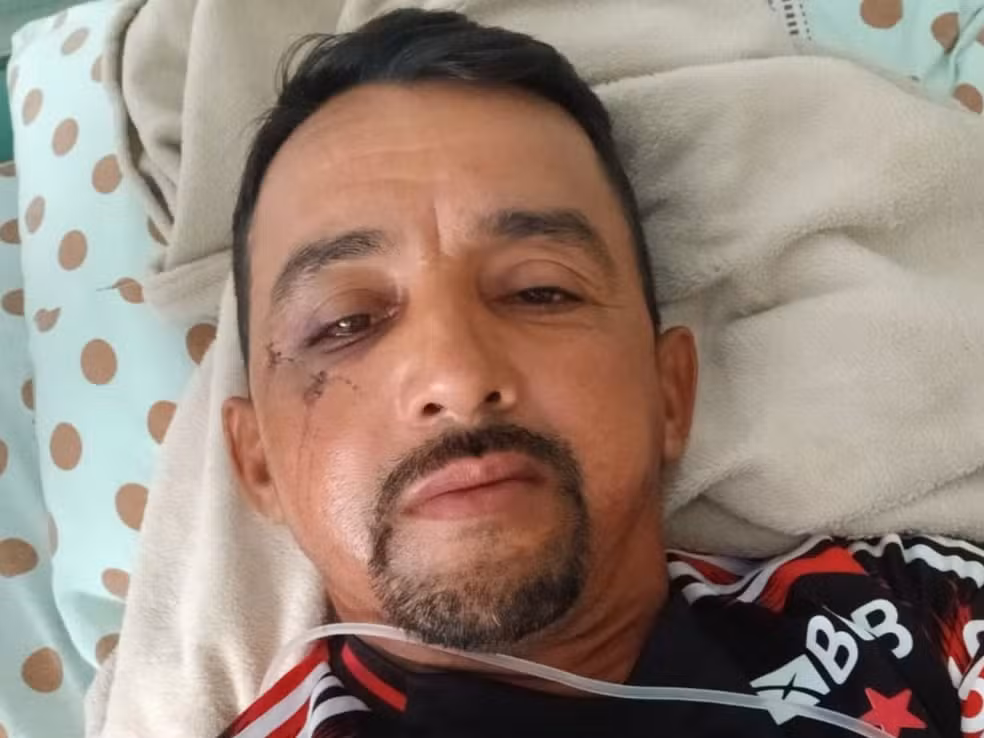 Gari que trabalha coletando resíduos há 14 anos na capital, disse que nunca havia sido agredido — Foto: Arquivo pessoal