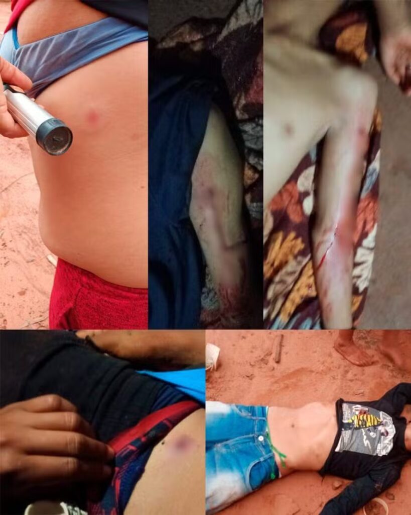 Ataque mata um indígena Guarani Kaiowá e deixa outros quatro feridos em Iguatemi, Mato Grosso do Sul. — Foto: Conselho Indigenista Missionário (Cimi)