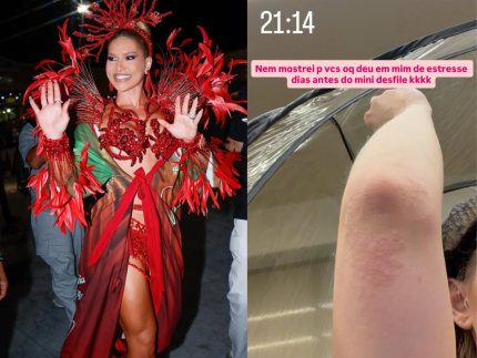 virginia-revela-que-teve-reacao-alergica-antes-de-minidesfile-na-cidade-do-samba:-“estresse”
