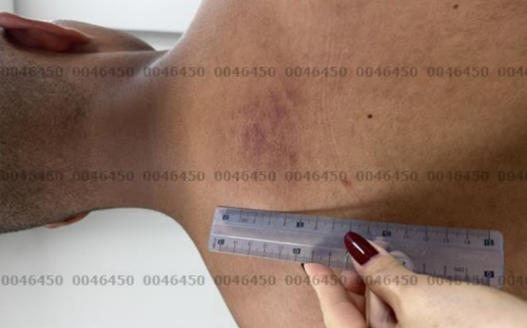 exame-de-corpo-de-delito-aponta-lesoes-em-feminicida-que-matou-cabo