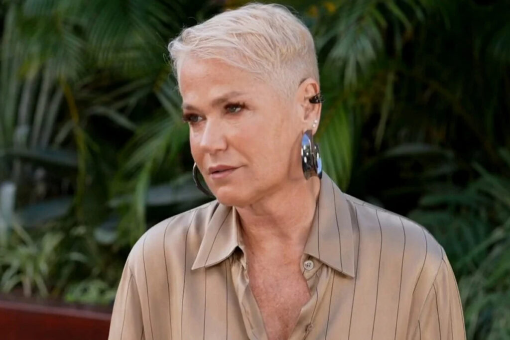 medico-explica-motivo-da-cirurgia-de-xuxa-e-detalha-quadro