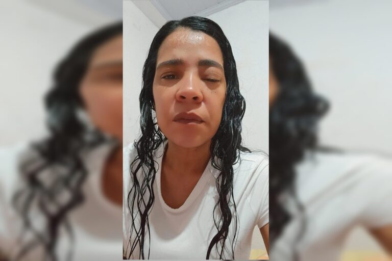 “sou-maltratada-pela-doenca-e-pelo-sus”,-diz-mulher-com-cancer-de-pele