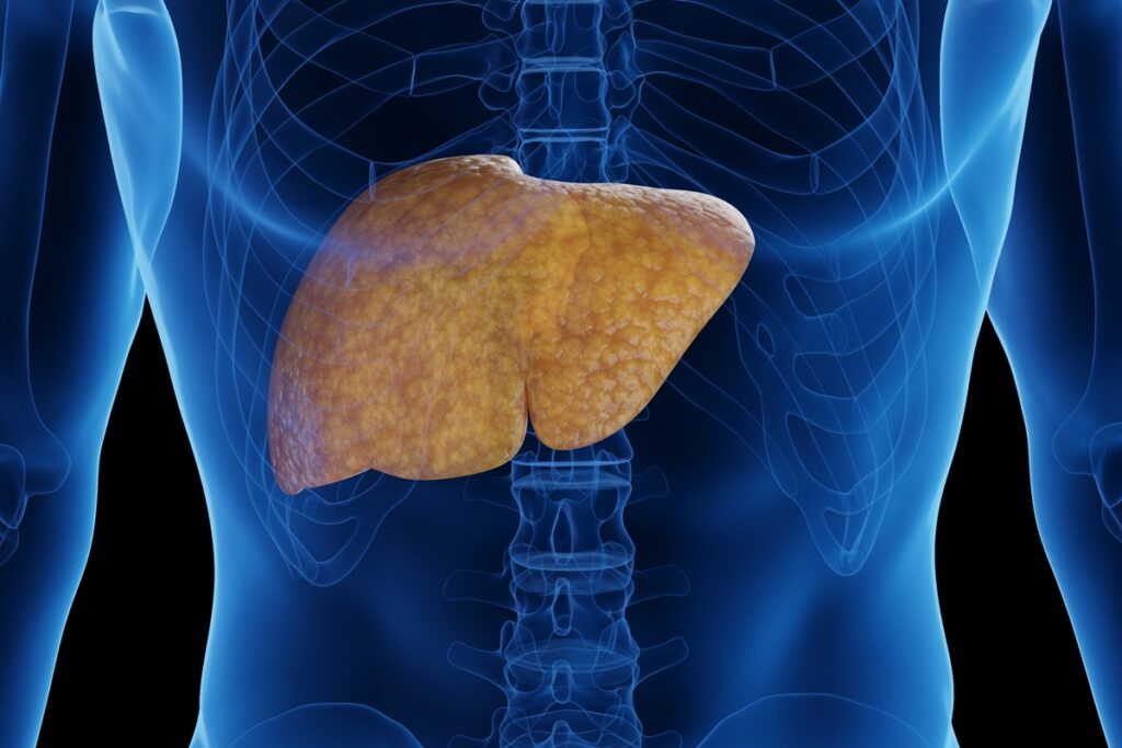 hepatologistas-contam-os-piores-alimentos-que-causam-gordura-no-figado