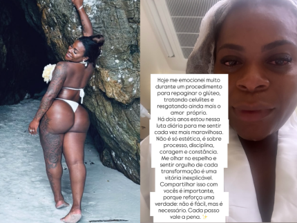 jojo-se-emociona-ao-fazer-procedimento-nos-gluteos:-“para-me-sentir-maravilhosa”