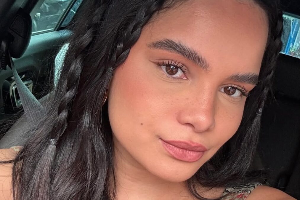 Atriz choca ao mostrar dedo ferido após acidente: “Não consegui fugir”