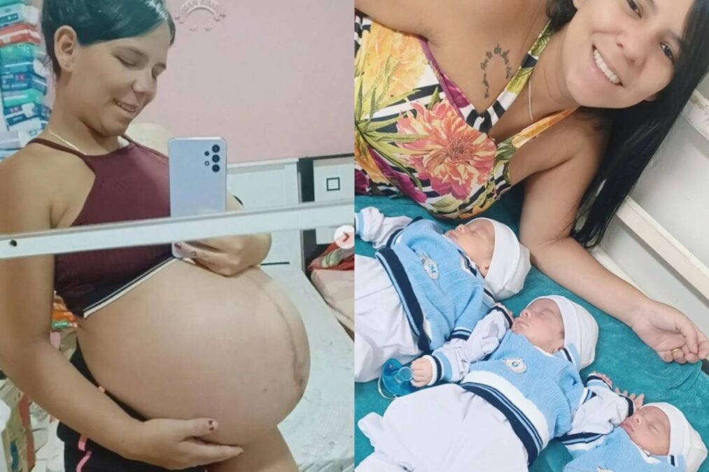 Mulher com 1,45 metro surpreende médicos ao dar à luz trigêmeos