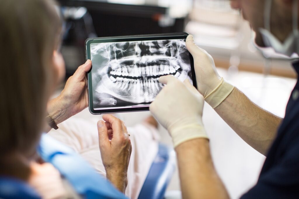 perda-de-dentes-em-idosos-piora-a-saude-e-aumenta-o-risco-de-morte