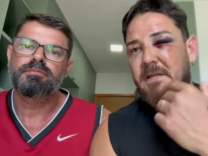 casal-de-turistas-espancados-em-porto-de-galinhas-vai-processar-municipio-e-estado