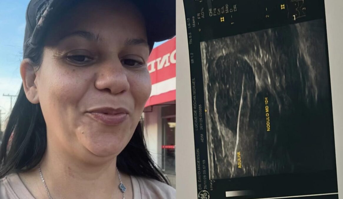 Moradora de Sena Madureira pede ajuda para realizar cirurgia de retirada de nódulo na mama