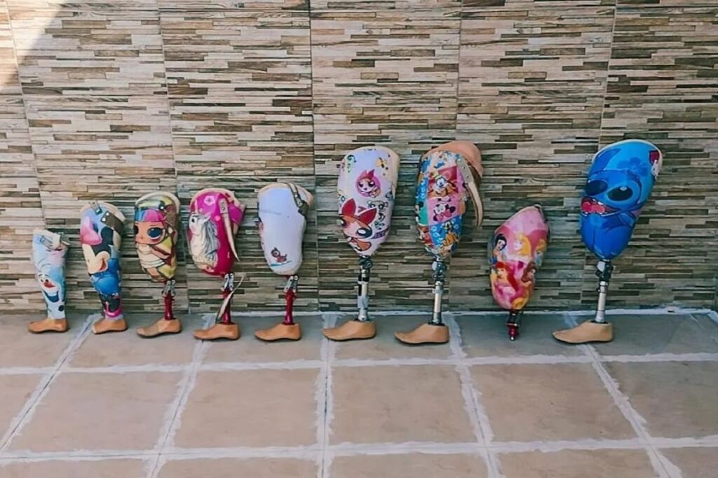 a-vida-de-uma-crianca-amputada.-como-funciona-acesso-a-proteses-em-sp