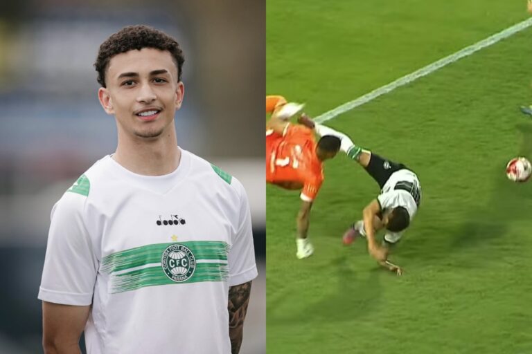 atacante-do-coritiba-quebra-o-braco-em-jogo-de-estreia-pelo-paranaense.-video