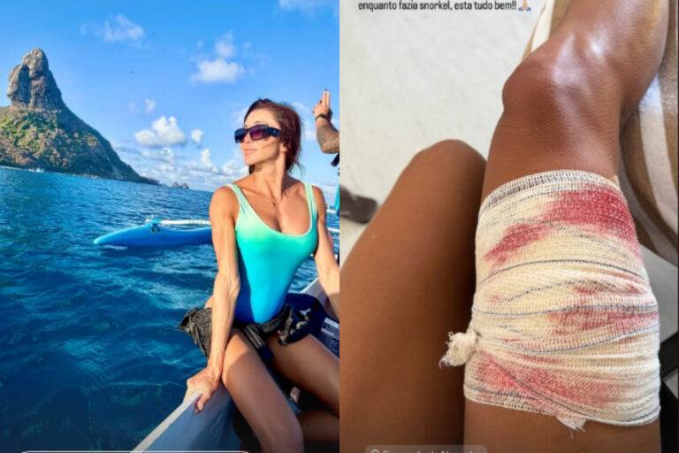 noronha:-veja-exato-momento-em-que-surfista-e-mordida-por-tubarao.-veja-video