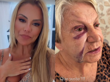 aos-84-anos,-mae-de-poliana-rocha-cai-em-casa-e-fica-com-hematomas-no-rosto