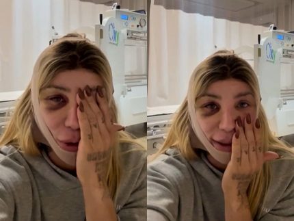 saiba-qual-foi-o-novo-procedimento-de-maya-massafera