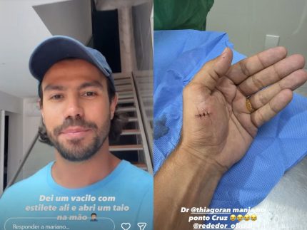 mariano,-dupla-de-munhoz,-sofre-acidente-domestico-e-precisa-levar-pontos-na-mao
