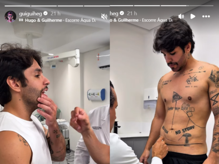 cantor-guilherme-corrige-preenchimento-de-barba-e-faz-procedimento-para-barriga-flacida