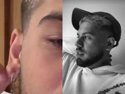 ze-felipe-realiza-novo-procedimento-apos-acidente-domestico:-“nao-cuidei-e-deu-isso”