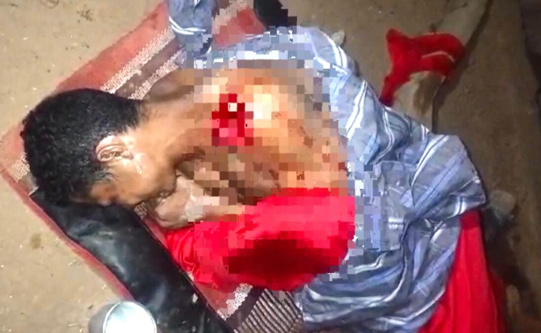 Homem fica gravemente ferido após briga entre irmãos na zona rural de Sena Madureira