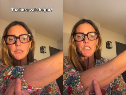 fernanda-lima-ironiza-sobre-manchas-na-pele:-“achei-que-ia-envelhecer-numa-boa”