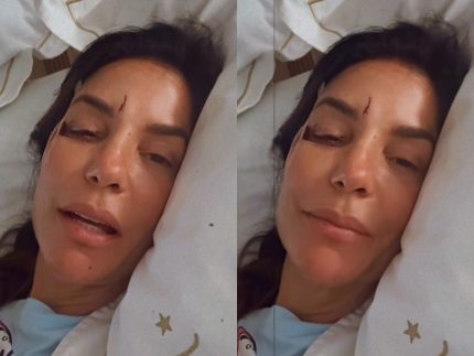 Ivete adianta alta hospitalar após cirurgia no rosto e agradece equipe médica: “Estou ótima” ivete-adianta-alta-hospitalar-apos-cirurgia-no-rosto-e-agradece-equipe-medica:-“estou-otima”