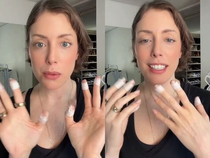 fabiana-justus-revela-diagnostico-de-transtorno-que-gera-vontade-de-machucar-a-pele