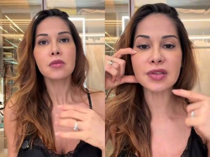 maira-cardi-busca-cirurgia-para-remover-procedimento-do-rosto:-“abrir-a-cara-inteira”