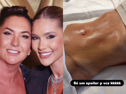 mae-de-virginia-impressiona-ao-exibir-barriga-chapada-apos-cirurgias-plasticas